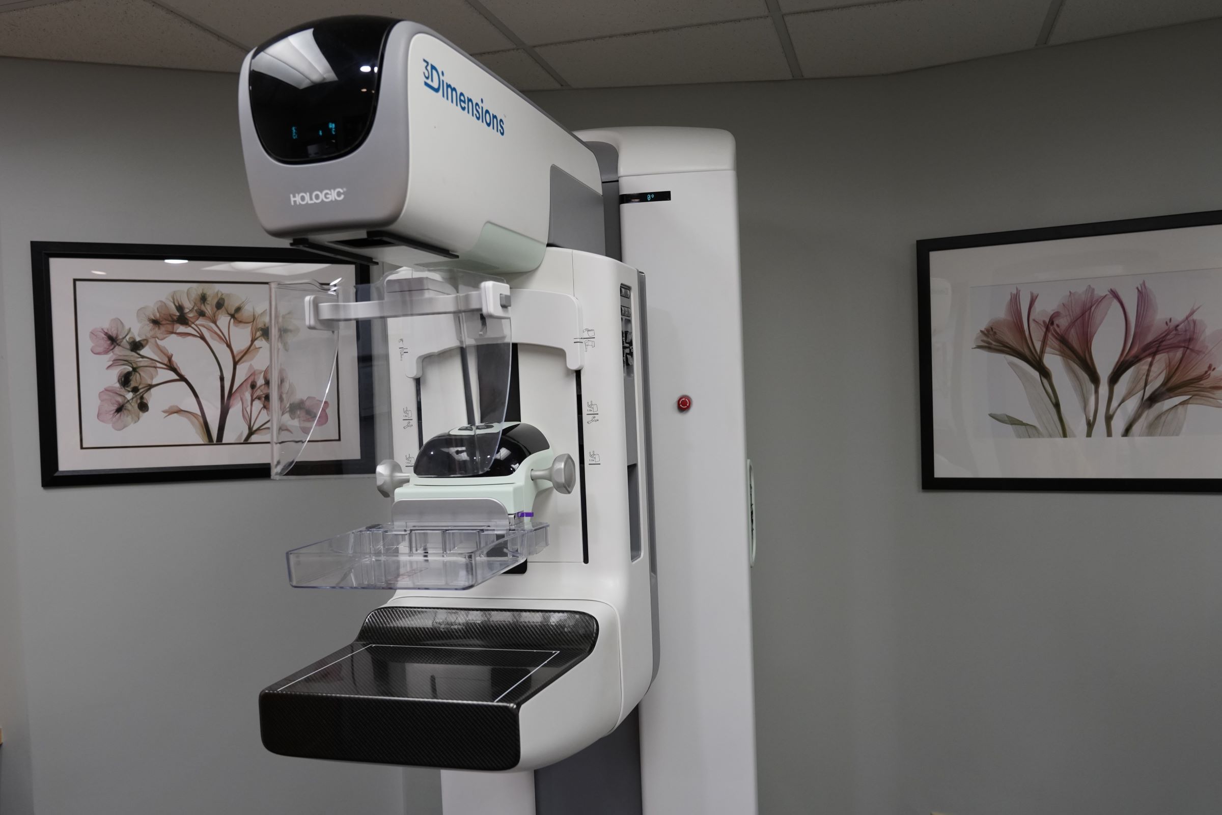 mammogram machine