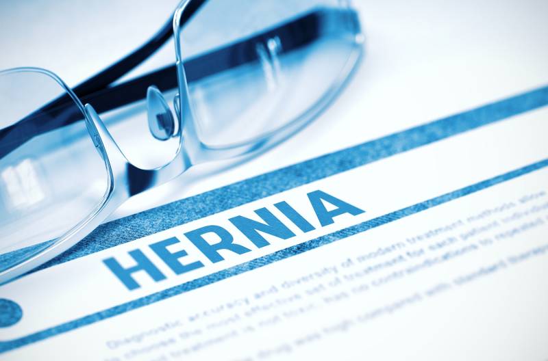 Your Hernia Questions, Answered